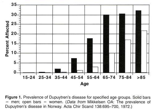 Prevalence of Dupuytren's contracture for different age groups.